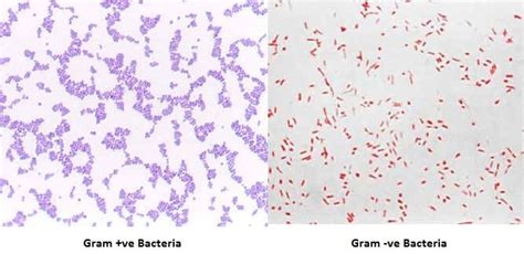 Gram Staining: Principle, Procedure, Interpretation, Examples and Animation