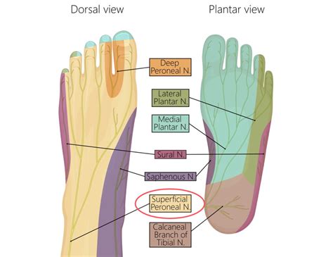 Understanding a Pinched Nerve in Calf - Sport Doctor London