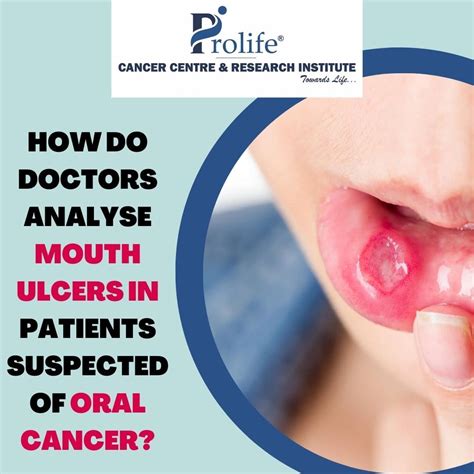 How Doctors Analyse Mouth Ulcers In Patients Suspected Of Oral Cancer?