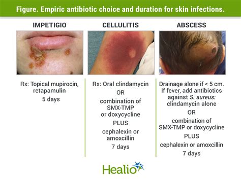 Stewardship in the pediatrician’s office: Antibiotic use for skin ...