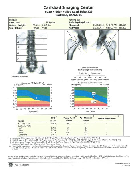 Bone Densitometry/DEXA scan - Carlsbad Imaging Center - Imperial Radiology