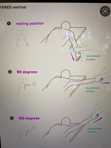 Shoulder reduction techniques Flashcards | Quizlet