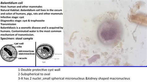 30- Practical Parasitology - Balantidium coli - Cyst Stage - YouTube