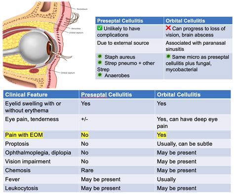 Orbital Cellulitis Adult Treatment