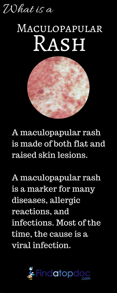 Maculopapular Rash: Symptoms, Causes and Treatment