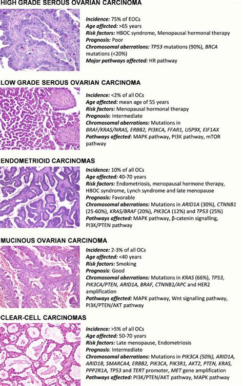 Ovarian Cancer: Molecular Classification and Targeted Therapy | IntechOpen