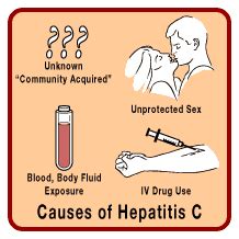 Hepatitis C