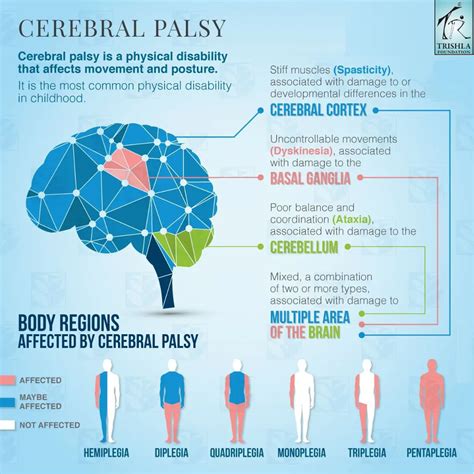 Cerebral Palsy Brain