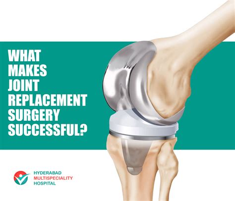 What makes Joint Replacement surgery Successful? - HYDERABAD MULTI ...