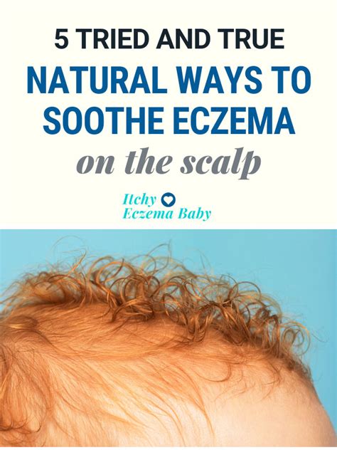 5 Best Home Remedies for Eczema on the Scalp | Itchy Eczema Baby