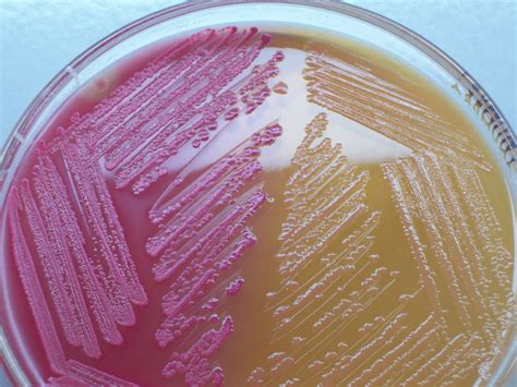 MCQ in Microbiology and Microbiology Class Notes: Types of ...