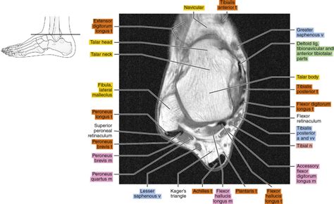 MRI of the ankle | Radiology Key