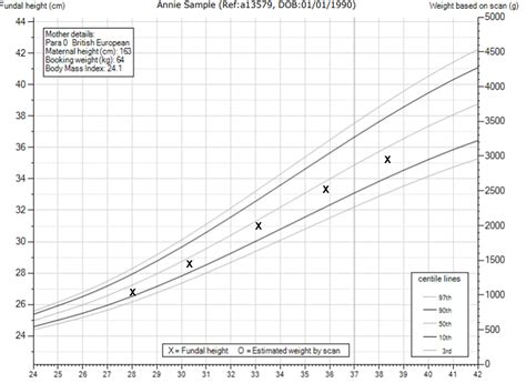 fetal weight chart uk