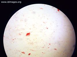 Pseudomonas Images - Infectious Disease Images - eMicrobes Digital ...