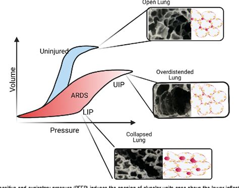 Figure 2 from Ventilator-Associated Lung Injury | Semantic Scholar