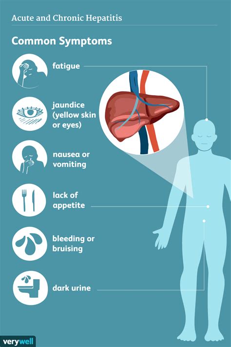 Hepatitis C Symptoms and Complications