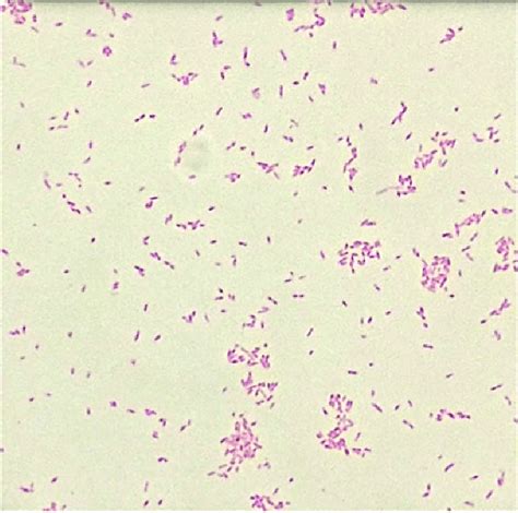 Gram Negative Coccobacilli Chart