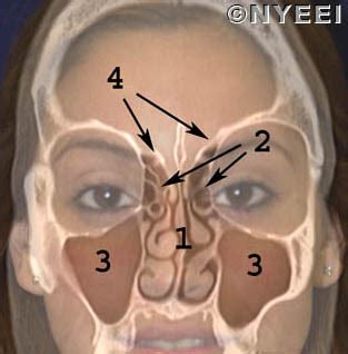 Skull Base Tumor Types - Signs - Symptoms - NYEE