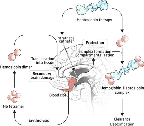 Haptoglobin Treatment for Aneurysmal Subarachnoid Hemorrhage: Review ...