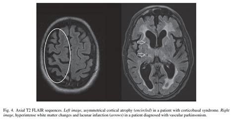 Clinical Application of Brain MRI in the Diagnostic Work-up of ...