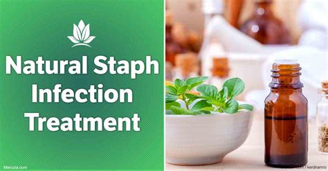 Natural Staph Infection Treatment