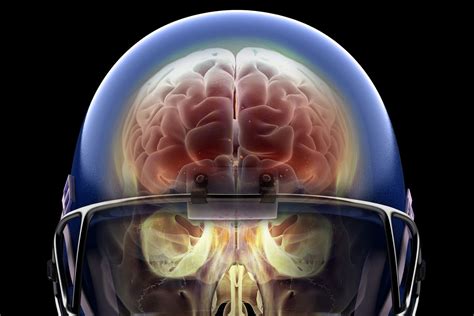 Football concussions: The link between head injuries and CTE, explained ...