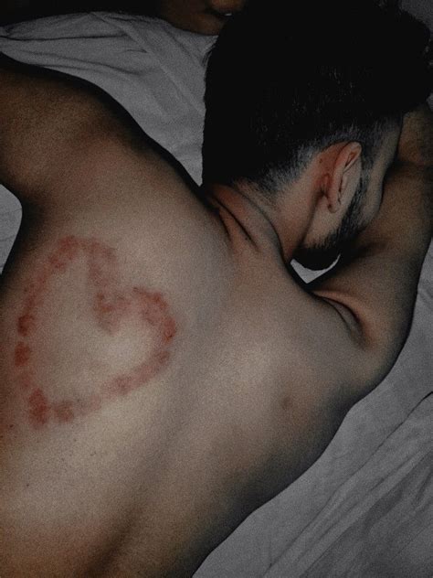 heart shaped hickey on back ft boyfriend. 🤭🫶 | Mood with bae, Heart ...