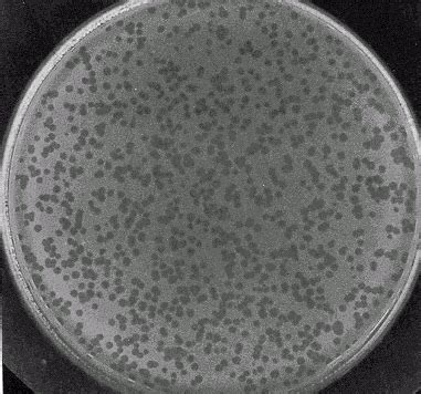 Bacteriophage Plaque Assay: Principle, Procedure and Results - Learn ...