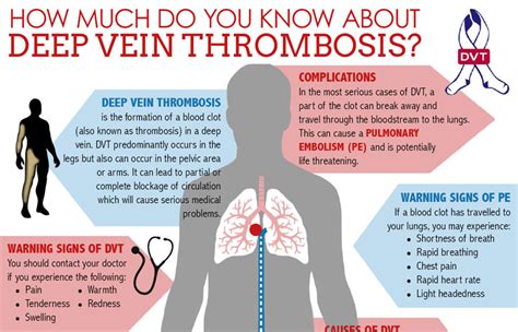 Deep Vein Thrombosis Infographic - Michigan Vein Care Specialists