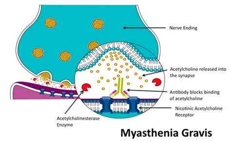 What is Myasthenia Gravis? — Live Oak Veterinary Neurology