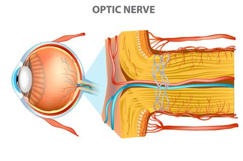 Optic Nerve Swelling (Papilledema) - Harvard Health