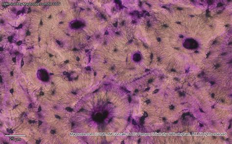 Histology: Reticular tissue