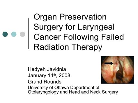 Organ Preservation Surgery For Laryngeal Cancer