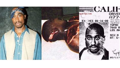 Tupac Shakur Death Autopsy