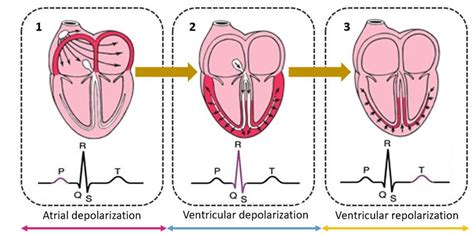 Successive Stages of Depolarization/repolarization of the Heart ...