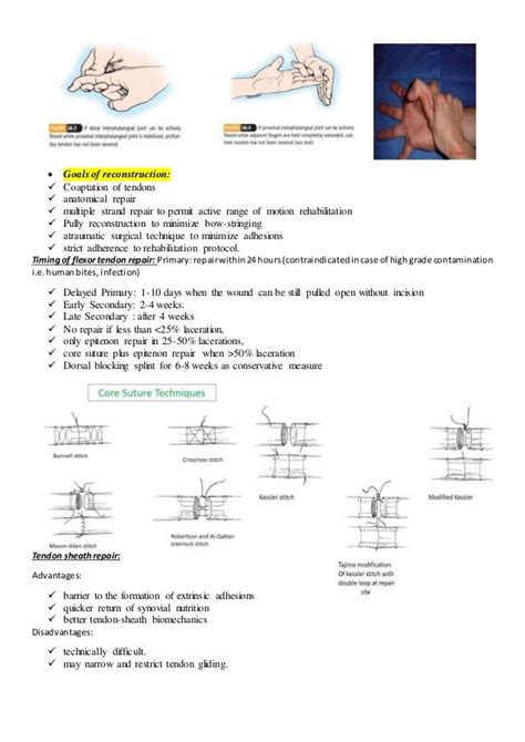 Tendon injury by dr yash