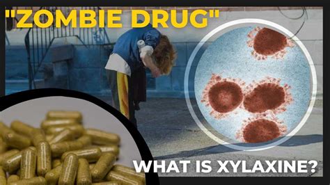 What Is Xylazine? How Is The Drug 'Zombifying' People’s Bodies? All You ...