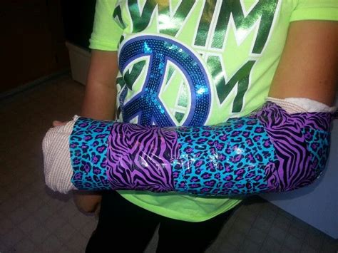 Arm cast made cool with duct tape | duct tape | Pinterest | Arm Cast ...