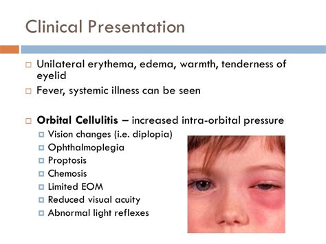 Preseptal Cellulitis Vs Orbital Cellulitis