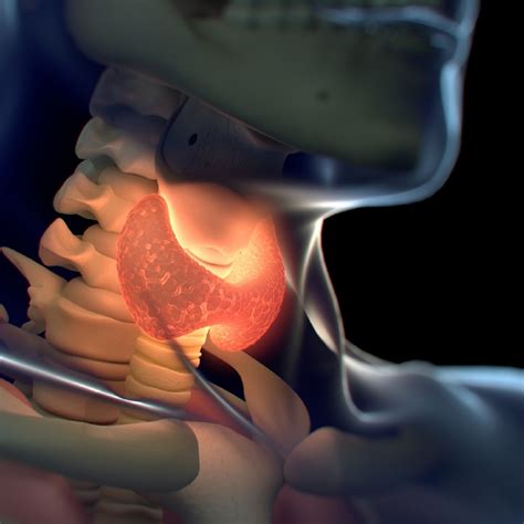 Thyroid Disease