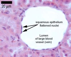 Simple Squamous Epithelium, Chapter 1 Page 7 Histologyolm - This type ...