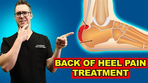 Retrocalcaneal Heel BURSITIS Treatment [Heel Pain Exercises & Massage ...