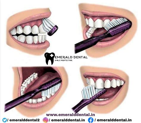 WHY CORRECT BRUSHING TECHNIQUE IS IMPORTANT ! - EMERALD DENTAL