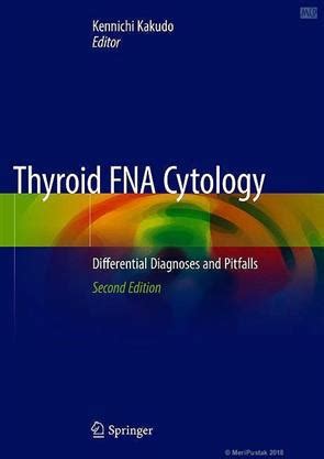 Thyroid Fna Cytology, Internal Medicine Books, Springer