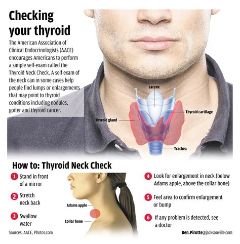 Thyroid symptoms site | Thyroid symptoms