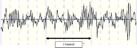 Beta Waves - Scottsdale Neurofeedback Institute, AZ