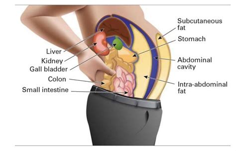 What is the Difference Between Visceral and Subcutaneous Fat - Pediaa.Com