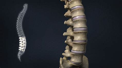 Laminectomy Of The Spine - Indications, Surgery Technique ...