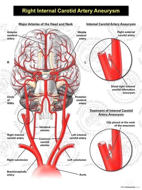 Internal Carotid Artery Supplies