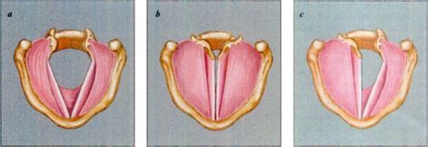 Vocal Cord Paralysis, Treatment, Surgery - ENT Clinic